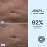 NuBODY Skin Toning Device for Body