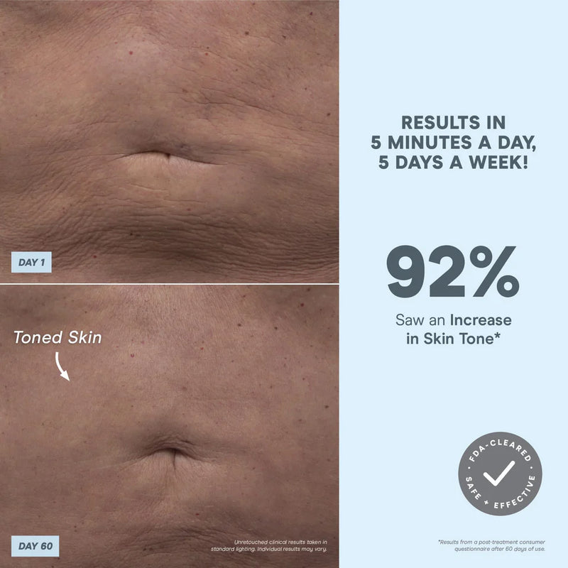 NuBODY Skin Toning Device for Body