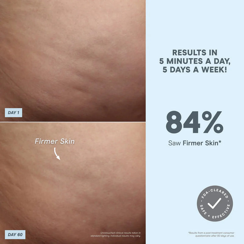 NuBODY Skin Toning Device for Body