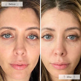 Omnilux Contour™ Face