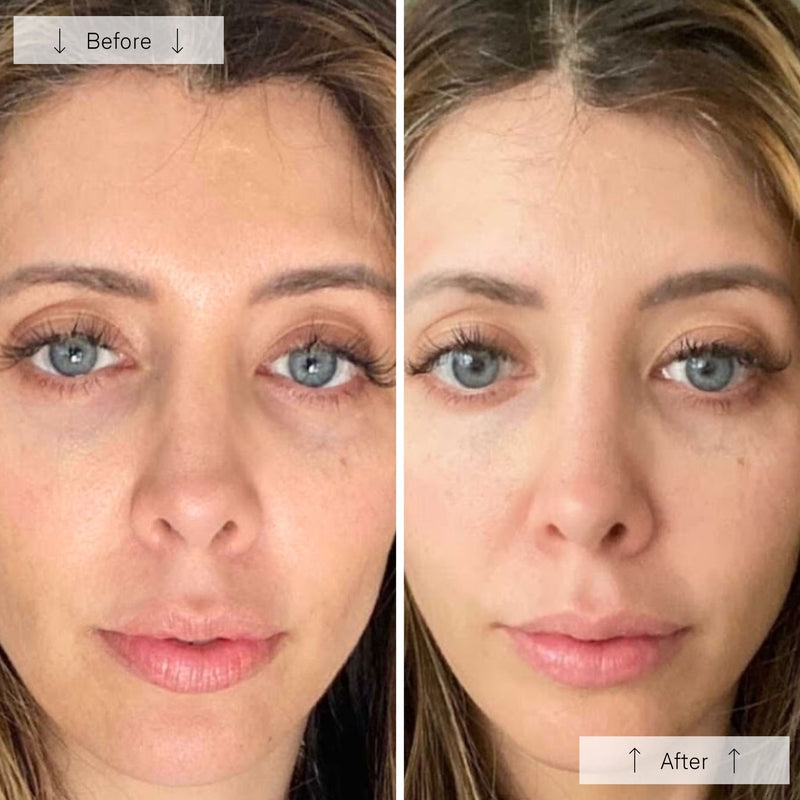 Omnilux Contour™ Face