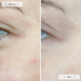 Omnilux Contour™ Face