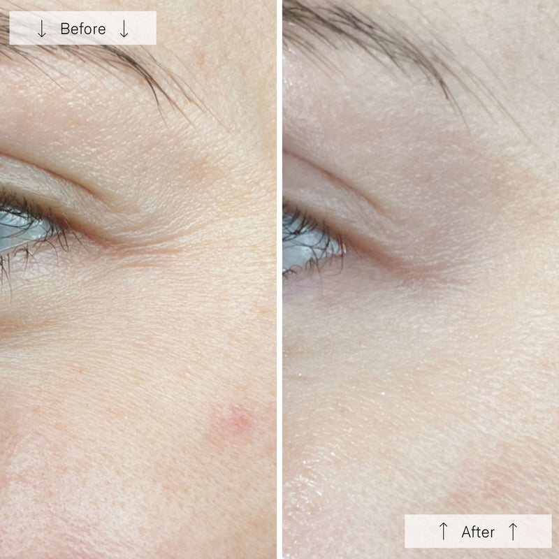 Omnilux Contour™ Face