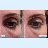 IonPlex Hydra-Gel Power Patches